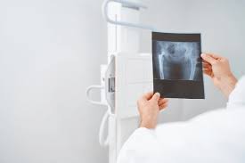 Persiapkan Ujian Anda dengan Tryout Online Simulasi Radiografer