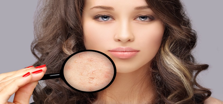 Jerawat Kabur dan Kulit Mulus Kembali dengan Treatment di Beautylogica